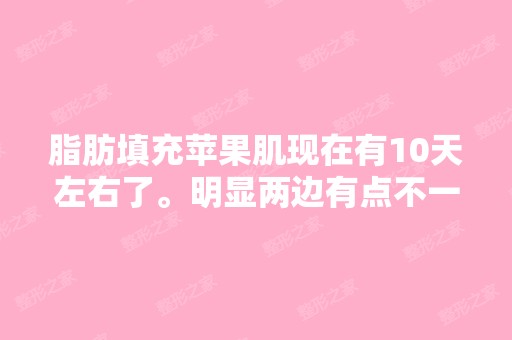 脂肪填充苹果肌现在有10天左右了。明显两边有点不一样。感觉大小脸...