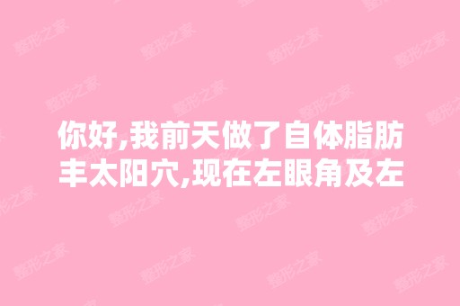 你好,我前天做了自体脂肪丰太阳穴,现在左眼角及左眼下方淤青,...