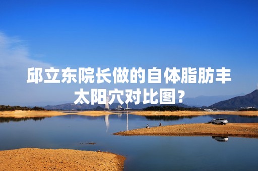 邱立东院长做的自体脂肪丰太阳穴对比图？