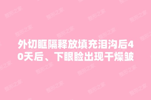 外切眶隔释放填充泪沟后40天后、下眼睑出现干燥皱...