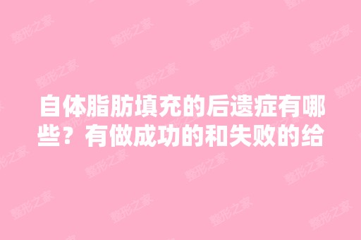 自体脂肪填充的后遗症有哪些？有做成功的和失败的给分享一下好吗？