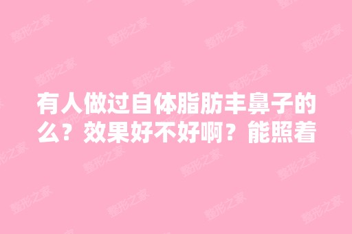 有人做过自体脂肪丰鼻子的么？效果好不好啊？能照着明星的鼻子来丰...