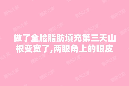 做了全脸脂肪填充第三天山根变宽了,两眼角上的眼皮下垂了,心里...