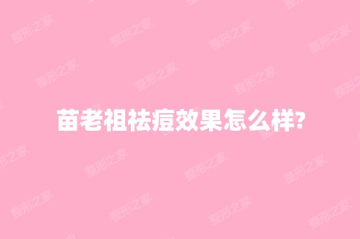 苗老祖祛痘效果怎么样?