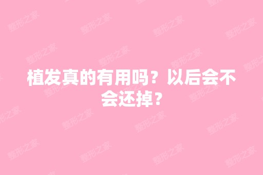 植发真的有用吗？以后会不会还掉？