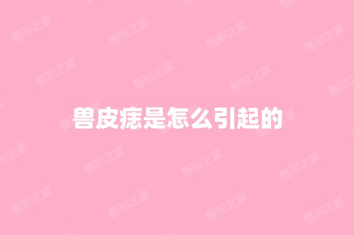 兽皮痣是怎么引起的