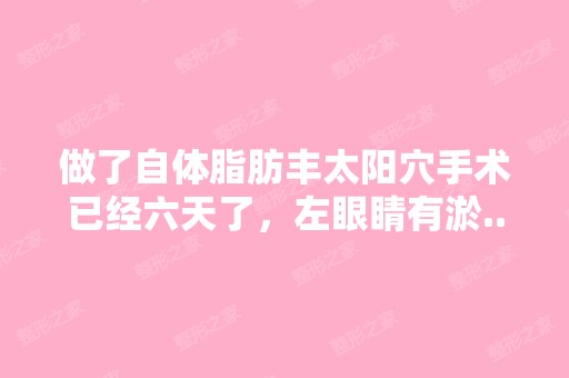 做了自体脂肪丰太阳穴手术已经六天了，左眼睛有淤...