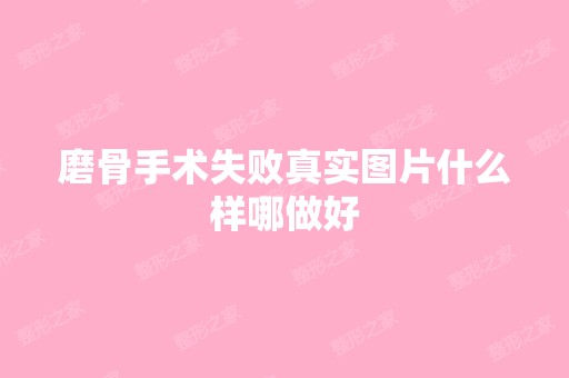 磨骨手术失败真实图片什么样哪做好