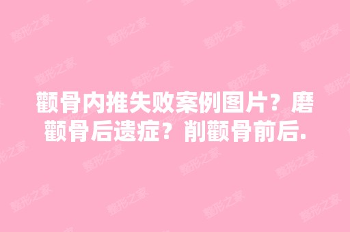 颧骨内推失败案例图片？磨颧骨后遗症？削颧骨前后...