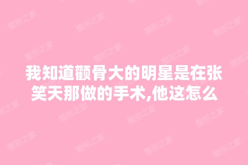 我知道颧骨大的明星是在张笑天那做的手术,他这怎么样