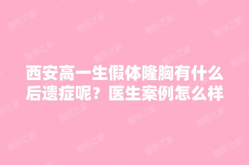 西安高一生假体隆胸有什么后遗症呢？医生案例怎么样？