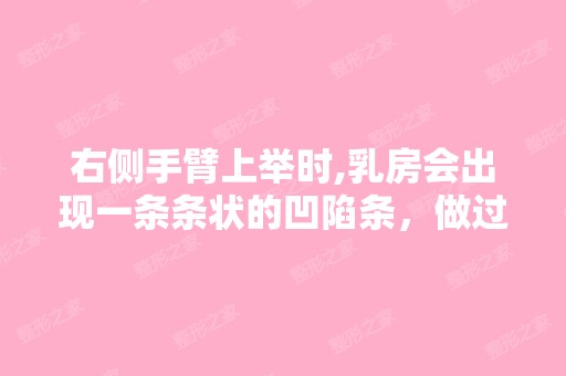 右侧手臂上举时,乳房会出现一条条状的凹陷条，做过...