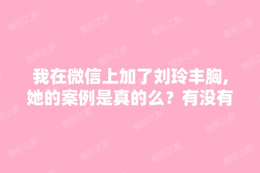 我在微信上加了刘玲丰胸,她的案例是真的么？有没有用过的朋友？...