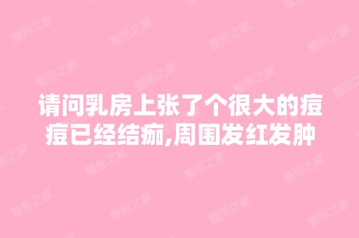 请问乳房上张了个很大的痘痘已经结痂,周围发红发肿...