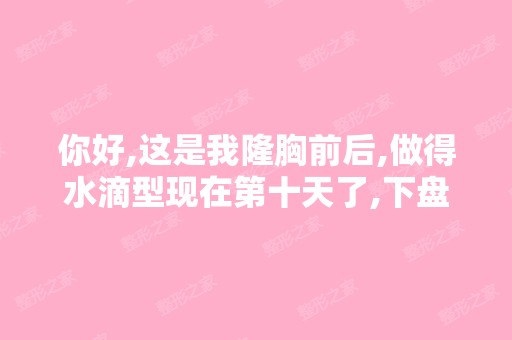 你好,这是我隆胸前后,做得水滴型现在第十天了,下盘还在肿胀,...