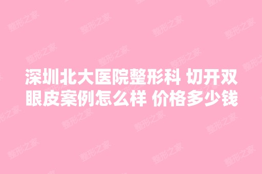 深圳北大医院整形科 切开双眼皮案例怎么样 价格多少钱