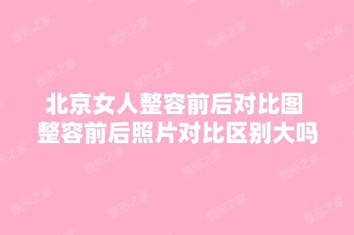 北京女人整容前后对比图 整容前后照片对比区别大吗