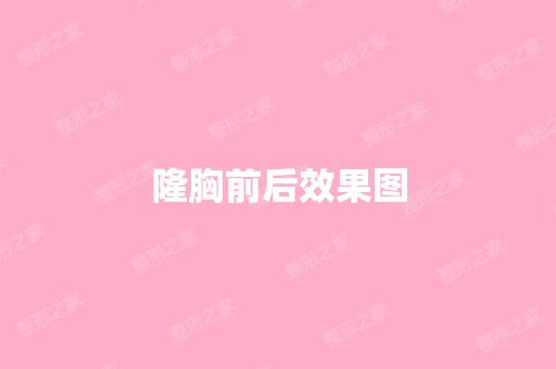 隆胸前后效果图