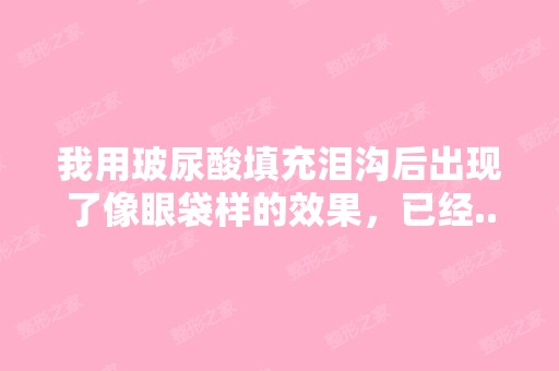 我用玻尿酸填充泪沟后出现了像眼袋样的效果，已经...