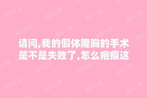 请问,我的假体隆胸的手术是不是失败了,怎么疤痕这么长,这么大,...