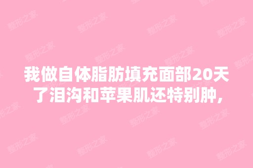 我做自体脂肪填充面部20天了泪沟和苹果肌还特别肿,正常吗