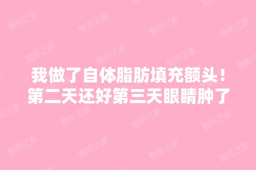 我做了自体脂肪填充额头！第二天还好第三天眼睛肿了还青了还紫色了...