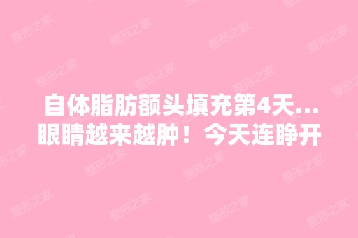 自体脂肪额头填充第4天…眼睛越来越肿！今天连睁开都费事了！！为...