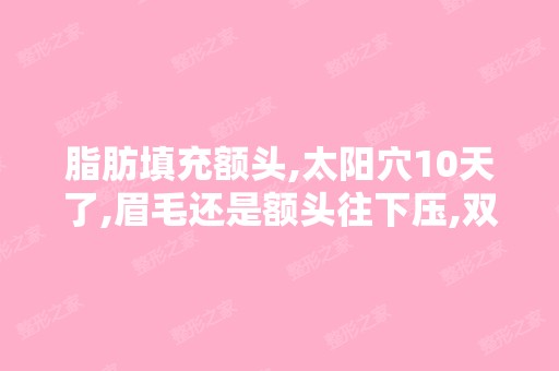 脂肪填充额头,太阳穴10天了,眉毛还是额头往下压,双眼皮也下沉...