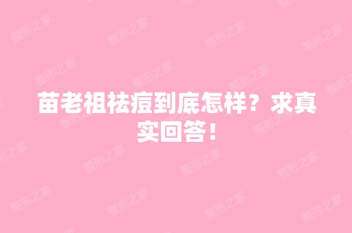 苗老祖祛痘到底怎样？求真实回答！