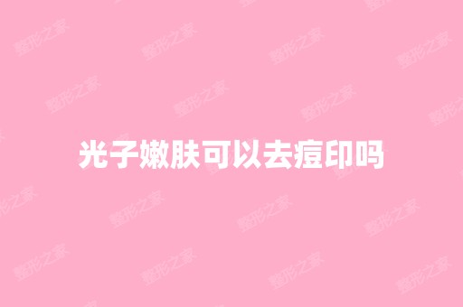 光子嫩肤可以去痘印吗