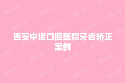 西安中诺口腔医院牙齿矫正案例