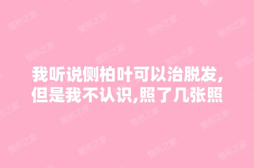 我听说侧柏叶可以治脱发,但是我不认识,照了几张照片,大家帮我鉴...