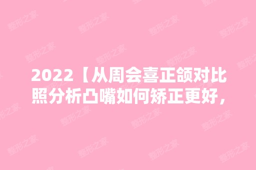 2024【从周会喜正颌对比照分析凸嘴如何矫正更好，技术太赞了】