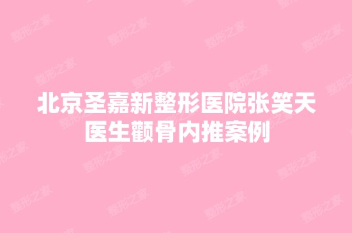 北京圣嘉新整形医院张笑天医生颧骨内推案例