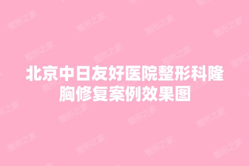 北京中日友好医院整形科隆胸修复案例效果图