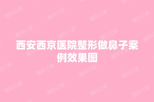 西安西京医院整形做鼻子案例效果图