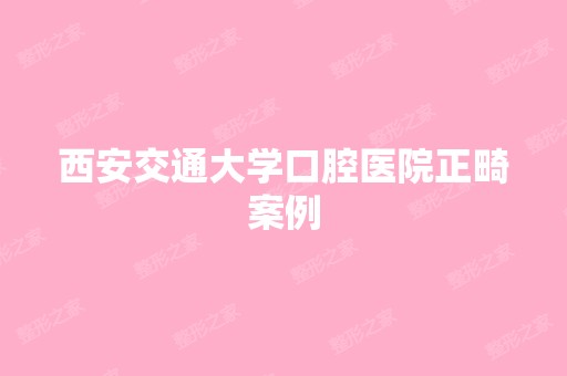 西安交通大学口腔医院正畸案例