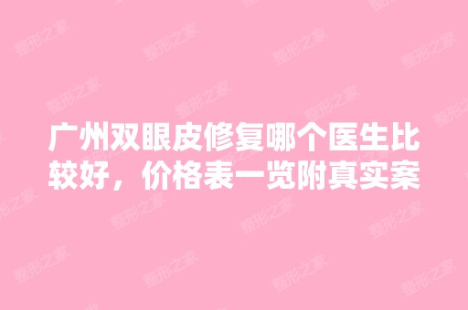 广州双眼皮修复哪个医生比较好，价格表一览附真实案例