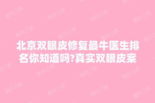 北京双眼皮修复牛医生排名你知道吗?真实双眼皮案例全过程分享