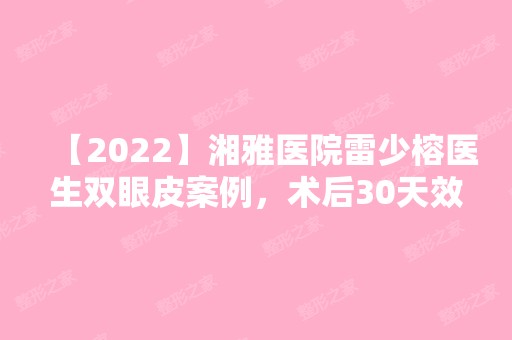 【2024】湘雅医院雷少榕医生双眼皮案例，术后30天效果