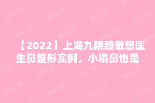 【2024】上海九院魏敬想医生鼻整形实例，小塌鼻也是有好日子的