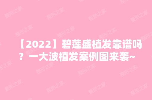 【2024】碧莲盛植发靠谱吗？一大波植发案例图来袭~