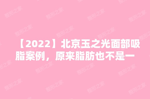 【2024】北京玉之光面部吸脂案例，原来脂肪也不是一无是处~