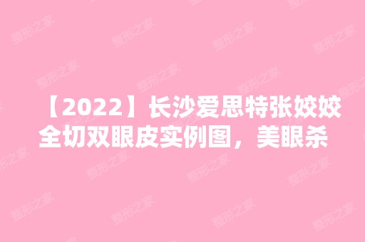 【2024】长沙爱思特张姣姣全切双眼皮实例图，美眼杀伤破坏力真强