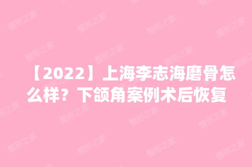 【2024】上海李志海磨骨怎么样？下颌角案例术后恢复效果分享_2024新项目表查询