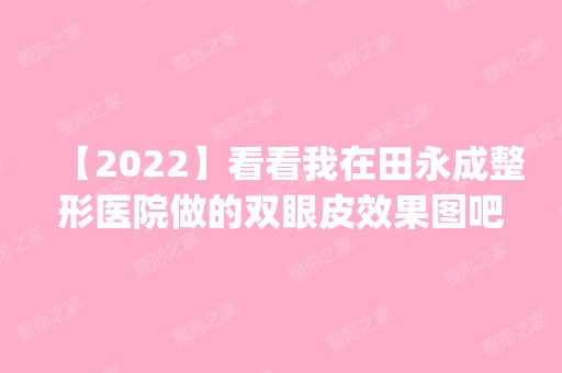 【2024】看看我在田永成整形医院做的双眼皮效果图吧_效果太好啦_价格表查询