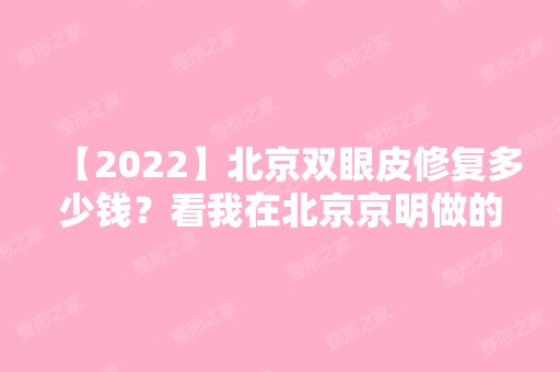 【2024】北京双眼皮修复多少钱？看我在北京京明做的修复案例