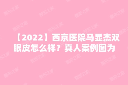 【2024】西京医院马显杰双眼皮怎么样？真人案例图为你揭晓