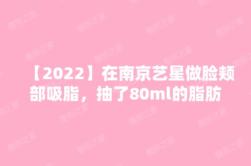 【2024】在南京艺星做脸颊部吸脂，抽了80ml的脂肪