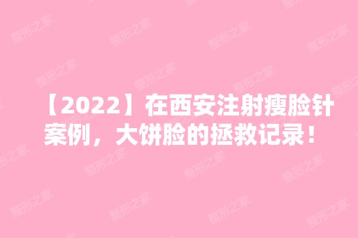 【2024】在西安注射瘦脸针案例，大饼脸的拯救记录！